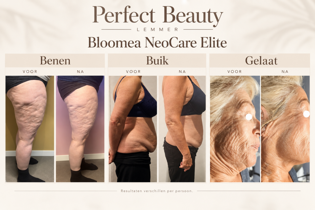 Werken aan een strakkere huid en een frisse uitstraling Bij Perfect Beauty